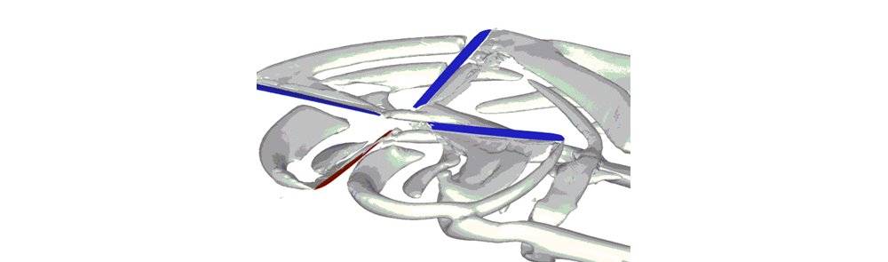 Blade vortex interaction noise happens when approaching blades hit the vortices of retreating blades.